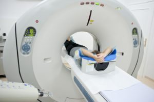 PET CT is useful for pre-operative staging for cervical cancer